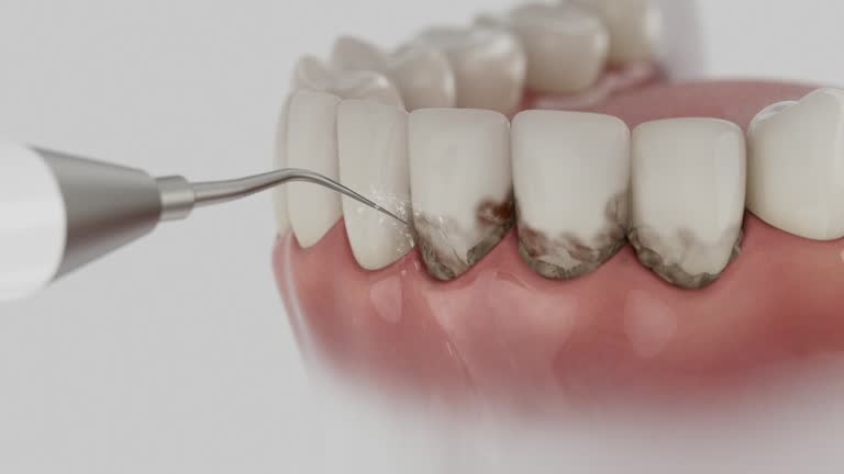 Trusted Tooth Extraction service in Andover, MN - Dentist Open Now